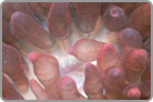 Rose Bubble Anemone